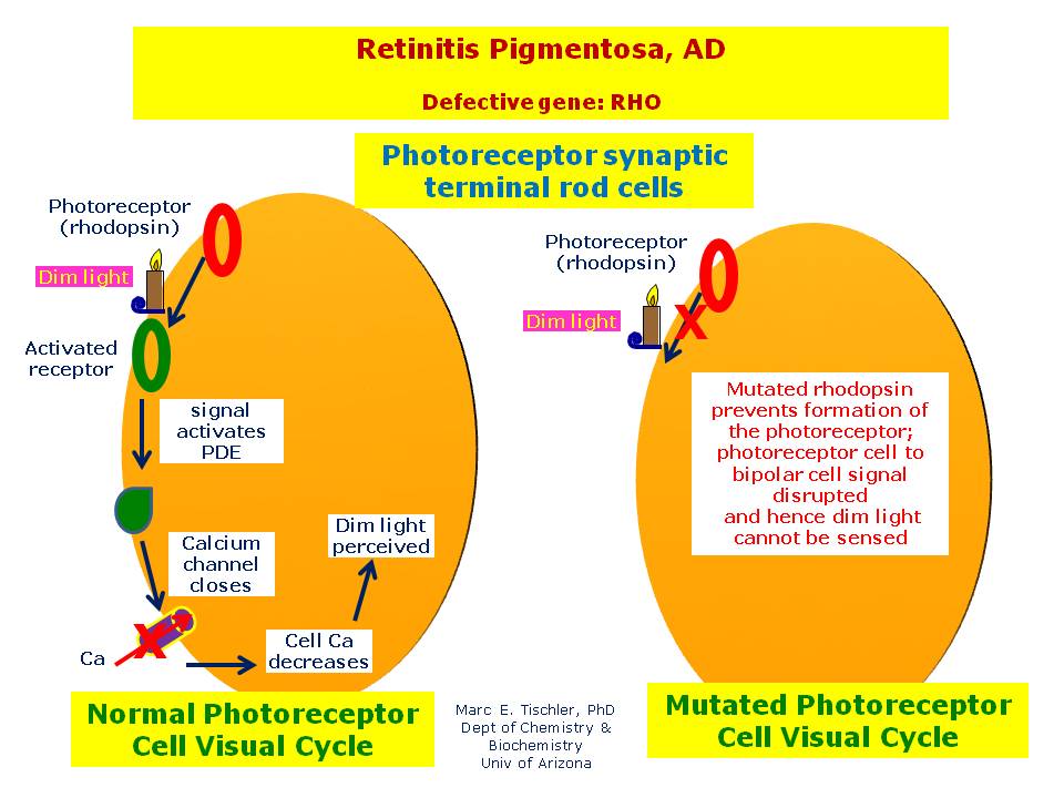 Retinitis pigmentosa ad hereditary ocular diseases